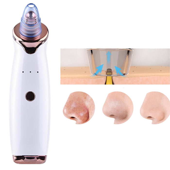 Blackhead Remover Vacuum